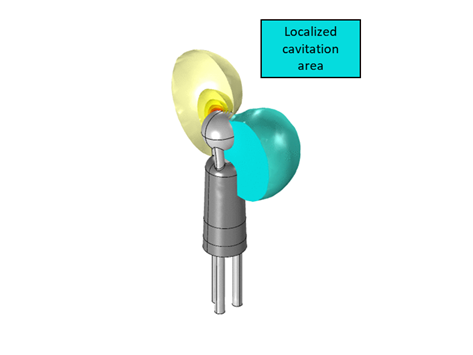 Modelling of an Innovative Directional Ultrasonic Atherosclerosis Treatment Device